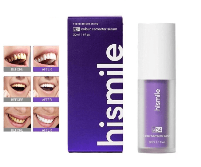 The viral Hismile V34 Colour Corrector serum, a purple, peroxide-free treatment designed to instantly whiten teeth using colour correcting technology.